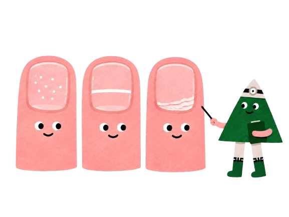 uñas huecas de los pies 
 uñas quebradizas causas
 líneas de Beau